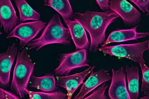 Illustrazione fotorealistica di cellule staminali mesenchimali umane (MSC) in coltura osservate al microscopio. Alcune cellule sono evidenziate da una fluorescenza verde brillante sulla membrana (simbolo di NRP2+), apparendo più grandi e vitali rispetto alle cellule non fluorescenti circostanti. Macro lens, 80mm, high detail, precise focusing, controlled lighting, sfondo scuro per risaltare la fluorescenza.