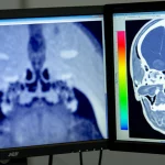 Visualizzazione fotorealistica di un'analisi CBCT della sincondrosi sfeno-occipitale su un monitor ad alta risoluzione, con sovrapposta un'interfaccia del software ImageJ che mostra l'istogramma e la pseudocolorazione 'Spectrum' dai colori vivaci, obiettivo macro 85mm, alta definizione, illuminazione controllata focalizzata sullo schermo in un ambiente di ricerca moderno.