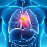 Visualizzazione 3D del torace umano che evidenzia la posizione del timo e un tumore timico, rendering medico fotorealistico ad alta definizione, illuminazione drammatica per enfatizzare l'area di interesse.