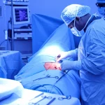 Fotografia di una sala operatoria durante un intervento ortopedico al bacino. Si vede il campo chirurgico illuminato, strumenti sterili e il team medico concentrato. L'immagine è scattata con un obiettivo prime da 35mm, con una profondità di campo ridotta che sfoca leggermente lo sfondo, mettendo a fuoco l'area dell'intervento. Toni di colore freddi, blu e grigio duotono, per un'atmosfera clinica ma intensa.