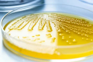 Immagine fotorealistica di colonie batteriche Xanthomonas giallo brillante che crescono su una piastra di Petri in un laboratorio scientifico. Obiettivo macro 105mm, illuminazione da studio controllata per massimizzare i dettagli delle colonie, messa a fuoco precisa sulla texture dei pigmenti, sfondo leggermente sfocato con attrezzatura da laboratorio.