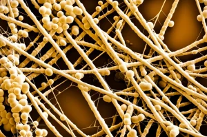 Immagine fotorealistica al microscopio di un biofilm di Streptococcus mutans in espansione su una superficie di idrossiapatite, evidenziando la matrice EPS collosa che trasporta cluster batterici e la formazione di nuove microcolonie, macro lens, 100mm, high detail, precise focusing, controlled lighting.