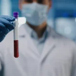 Fotografia di un ricercatore in camice bianco che tiene in mano una provetta di siero sanguigno controluce in un laboratorio moderno e luminoso, focus sulla provetta, sfondo sfocato con attrezzature scientifiche, obiettivo prime 35mm, profondità di campo, colori naturali.