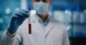 Fotografia di un ricercatore in camice bianco che tiene in mano una provetta di siero sanguigno controluce in un laboratorio moderno e luminoso, focus sulla provetta, sfondo sfocato con attrezzature scientifiche, obiettivo prime 35mm, profondità di campo, colori naturali.