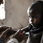 Un bambino yemenita gravemente malnutrito viene visitato da un operatore sanitario in un centro terapeutico TFC, luce soffusa che entra da una finestra laterale. L'operatore misura il braccio del bambino con un nastro MUAC. Fotografia stile reportage, obiettivo 35mm, profondità di campo che sfoca leggermente lo sfondo, bianco e nero per accentuare la drammaticità e la vulnerabilità.
