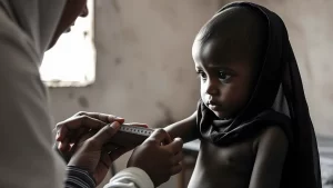 Un bambino yemenita gravemente malnutrito viene visitato da un operatore sanitario in un centro terapeutico TFC, luce soffusa che entra da una finestra laterale. L'operatore misura il braccio del bambino con un nastro MUAC. Fotografia stile reportage, obiettivo 35mm, profondità di campo che sfoca leggermente lo sfondo, bianco e nero per accentuare la drammaticità e la vulnerabilità.