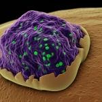 Visualizzazione 3D fotorealistica di uno scaffold PCL/β-TCP poroso impiantato in un difetto osseo alveolare simulato, con cellule staminali dentali luminescenti che colonizzano lo scaffold e iniziano a depositare matrice ossea. Illuminazione scientifica suggestiva, focus selettivo sullo scaffold e sulle cellule, alta definizione dei dettagli microscopici, stile illustrativo medico.