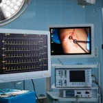 Fotografia realistica di una sala operatoria moderna durante un intervento all'anca, focus su un monitor paziente che mostra un tracciato della pressione arteriosa con evidente variabilità, luce chirurgica intensa, dettagli nitidi sull'attrezzatura, obiettivo 24mm per un contesto ampio ma con focus sul monitor.