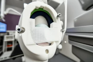 Fotografia close-up di un compensatore di fascio protonico stampato in 3D, realizzato in materiale plastico bianco (PLA), posizionato su una maschera termoplastica per immobilizzazione pediatrica. L'ambientazione è una sala di trattamento di protonterapia simulata, con luci soffuse e controllate. L'obiettivo è un 60mm macro lens, che cattura l'alta definizione dei dettagli della stampa 3D e la perfetta aderenza del compensatore alla maschera. Messa a fuoco precisa sul compensatore.