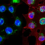 Rendering 3D fotorealistico di cellule tumorali ovariche (OVCAR3 e SKOV3) in coltura, sottoposte a stress da taglio simulato da un flusso di liquido. Evidenziazione delle membrane cellulari con accumulo di colesterolo (visualizzato con fluorescenza blu brillante usando Filipin stain) e del nucleo con fattori di trascrizione YAP1/SREBP2 (rosso/verde). Macro lens, 100mm, high detail, precise focusing, controlled lighting.