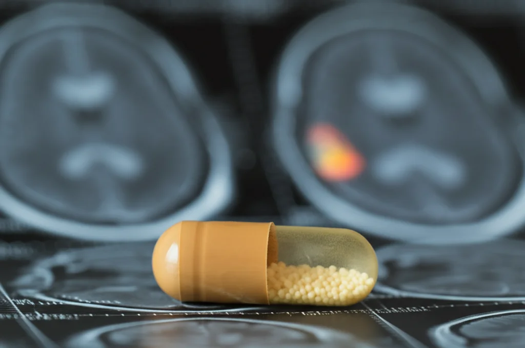 Primo piano di una capsula di meldonium su uno sfondo sfocato di una risonanza magnetica cerebrale con un glioblastoma evidenziato. Illuminazione da laboratorio controllata, lente macro 90mm, alta definizione, focus preciso sulla capsula.