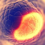 Immagine concettuale fotorealistica del cervello umano con aree evidenziate che rappresentano lesioni da sclerosi multipla. Una lesione in particolare mostra un bordo ampio e infiammato (BRL), visualizzato con colori caldi intensi (rosso/arancione) che si distinguono dal tessuto circostante. L'immagine utilizza una profondità di campo ridotta per mettere a fuoco la lesione BRL, con uno sfondo leggermente sfocato che suggerisce la complessità del cervello. Lente prime 35mm, stile duotone blu e arancione per un contrasto scientifico ed evocativo.