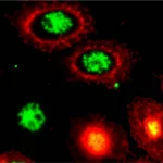 Immagine macro ad alta definizione di cellule staminali tumorali del polmone in coltura 3D (tumorsfere), con evidenziazione fluorescente della proteina SIGMAR1 su alcune cellule. Obiettivo macro 100mm, illuminazione controllata per dettaglio preciso, sfondo scuro per risaltare la fluorescenza.