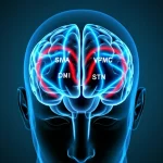 Visualizzazione 3D del cervello umano con evidenziate le aree motorie (M1, SMA, DPMC, VPMC) e il nucleo subtalamico (STN), con linee luminose blu (beta) che si affievoliscono tra STN e corteccia e linee luminose rosse (gamma) che si intensificano tra le aree corticali motorie, rappresentando l'effetto della DBS. Stile scientifico high-tech, alta definizione, sfondo scuro, wide-angle 15mm.