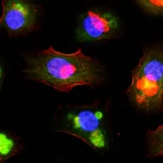 Immagine macro ad alta definizione di cellule di cancro al seno sotto un microscopio, obiettivo macro 90mm, con evidenziazione fluorescente di un inibitore PARP radiomarcato legato all'enzima PARP-1 all'interno dei nuclei cellulari. Illuminazione controllata da laboratorio, profondità di campo ridotta per focalizzare sui nuclei.