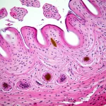 Macro fotografia, 80mm lens, di una sezione di tessuto gengivale sotto un microscopio, evidenziando le cellule epiteliali in superficie e il tessuto connettivo sottostante con infiltrazione di cellule immunitarie (alcune evidenziate con colorazione immunoistochimica per IL-37, magari in marrone). High detail, precise focusing, controlled lighting simulando condizioni di laboratorio.