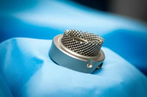 Close-up drammatico, lenti macro 100mm, di un impianto di cono tantalum poroso per la chirurgia di revisione del ginocchio appoggiata su un drappeggio chirurgico blu sterile. La messa a fuoco precisa evidenzia la complessa struttura metallica contro la trama del tessuto morbido. L'illuminazione controllata enfatizza i dettagli del materiale.