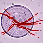 Immagine concettuale di un ovocita umano circondato da una zona pellucida imperfetta o assente, con evidenza di strutture proteiche ZP1 e ZP3 anomale visualizzate come filamenti interrotti o aggregati. Illuminazione controllata per evidenziare il difetto, lente macro 90mm, alta definizione, sfondo sfocato che suggerisce l'ambiente ovarico.