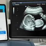 Immagine fotorealistica di un'ecografia ostetrica visualizzata su uno schermo ad alta definizione, accanto a un tablet che mostra una conversazione con un chatbot AI, obiettivo macro 100mm, focus nitido sull'immagine ecografica, illuminazione da studio.