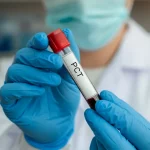 Primo piano di una provetta di sangue con etichetta 'PCT' tenuta da un tecnico di laboratorio in guanti blu, sfondo sfocato di un laboratorio medico, illuminazione controllata, lente macro 100mm, alta definizione.