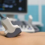 Primo piano di una sonda ecografica lineare appoggiata sul torace di un paziente in un ambiente di Pronto Soccorso. Si intravede sullo sfondo sfocato un monitor con artefatti ecografici polmonari (linee B). Illuminazione controllata, obiettivo macro 85mm, alta definizione dei dettagli della sonda e della cute, atmosfera clinica ma rassicurante.