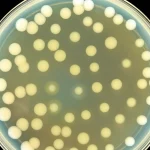 Fotografia macro di una piastra di Petri con colonie batteriche di Bacillus cereus su agar amido, che mostrano chiare zone di idrolisi dopo l'aggiunta di iodio di Lugol. Illuminazione controllata da laboratorio, obiettivo macro 90mm, alta definizione dei dettagli delle colonie e delle zone chiare.