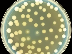 Fotografia macro di una piastra di Petri con colonie batteriche di Bacillus cereus su agar amido, che mostrano chiare zone di idrolisi dopo l'aggiunta di iodio di Lugol. Illuminazione controllata da laboratorio, obiettivo macro 90mm, alta definizione dei dettagli delle colonie e delle zone chiare.