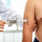 Medico che misura la plica cutanea tricipitale di un paziente oncologico in uno studio medico, utilizzando un calibro. Illuminazione clinica controllata, obiettivo prime 35mm, profondità di campo per mettere a fuoco la misurazione.