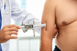 Medico che misura la plica cutanea tricipitale di un paziente oncologico in uno studio medico, utilizzando un calibro. Illuminazione clinica controllata, obiettivo prime 35mm, profondità di campo per mettere a fuoco la misurazione.