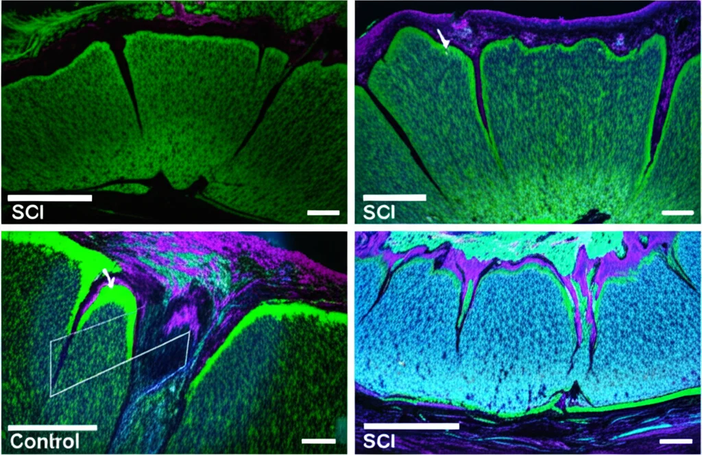 Immagine fotorealistica, macro lens 85mm, high detail, controlled lighting. Sezione trasversale di midollo spinale di ratto dopo lesione (SCI) e allenamento BWSTT. Si nota una ridotta area di cicatrice gliale (colorazione specifica, es. GFAP meno intensa) e tessuto nervoso più preservato rispetto a un controllo SCI non trattato. L'illuminazione evidenzia le differenze strutturali.