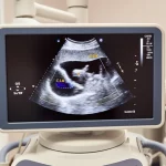 Immagine fotorealistica di un'ecografia dell'antro gastrico visualizzata su un moderno schermo medicale, con sovrapposizioni grafiche generate dall'intelligenza artificiale che evidenziano l'area (CSA) e la curva di motilità in tempo reale, obiettivo macro 80mm, alta definizione, illuminazione soffusa e controllata da sala diagnostica.
