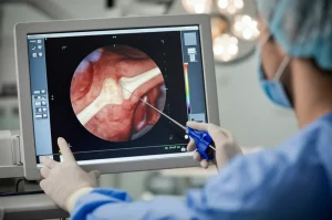 Primo piano di un radiologo interventista che osserva attentamente uno schermo di navigazione 3D durante una procedura di ablazione per osteoma osteoide. Focus sullo schermo che mostra l'anatomia ossea e la traiettoria dell'ago, e sulle mani guantate del medico che controllano gli strumenti. Lente prime 50mm, profondità di campo ridotta che sfoca lo sfondo della sala operatoria, illuminazione focalizzata sullo schermo e sul medico.