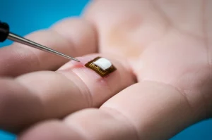 Fotografia macro, 85mm, di un innovativo elettrodo flessibile per neurostimolazione posizionato con precisione vicino a un nervo digitale della mano appena riparato chirurgicamente. Illuminazione da studio controllata che enfatizza la texture del nervo e la tecnologia dell'elettrodo, alta definizione, messa a fuoco selettiva.