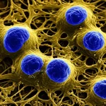 Immagine microscopica ad alta risoluzione di cellule di carcinoma polmonare non a piccole cellule (NSCLC), obiettivo macro 105mm, illuminazione laterale drammatica per evidenziare la struttura cellulare tridimensionale, focus nitido sulle cellule invasive che si infiltrano in una matrice extracellulare simulata.