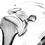 Primo piano di una sezione sagittale di risonanza magnetica della spalla, evidenziando la 'vista a r' all'incisura sovrascapolare, alta definizione, illuminazione controllata, obiettivo macro 90mm, che mostra chiaramente il muscolo sovraspinato con infiltrazione grassa moderata.