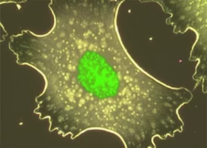 Fotografia macro, obiettivo 85mm, che mostra una cellula di mammifero sana in una piastra Petri. Dalla cellula viene secreta una proteina verde brillante (simbolo di sHRP) nel mezzo di coltura circostante, che appare chiaro. L'immagine simboleggia un sistema reporter non litico. High detail, precise focusing, illuminazione controllata che enfatizza la cellula e la proteina secreta.