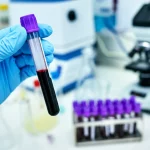 Fotografia medica realistica: primo piano di una provetta di sangue tenuta da una mano guantata in un laboratorio, con strumentazione scientifica sfocata sullo sfondo. Obiettivo macro 100mm, alta definizione, illuminazione precisa sulla provetta, riflessi controllati.
