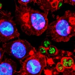 Immagine macro di neuroni cerebrali neonatali sotto stress ossidativo, con mitocondri visibili (alcuni normali, altri gonfi), illuminazione controllata e drammatica, alta definizione, obiettivo macro 100mm, che simboleggia l'impatto dell'ipossia neonatale e il ruolo centrale dei mitocondri.