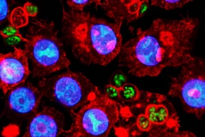 Immagine macro di neuroni cerebrali neonatali sotto stress ossidativo, con mitocondri visibili (alcuni normali, altri gonfi), illuminazione controllata e drammatica, alta definizione, obiettivo macro 100mm, che simboleggia l'impatto dell'ipossia neonatale e il ruolo centrale dei mitocondri.