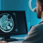 Immagine fotorealistica di un medico radiologo che analizza attentamente un'immagine di CPRM (Colangiopancreatografia a Risonanza Magnetica) su un monitor ad alta definizione in una sala refertazione moderna. Il monitor mostra chiaramente le vie biliari con multiple stenosi e dilatazioni tipiche della Colangite Sclerosante Primitiva (CSP). Luce controllata focalizzata sul monitor, obiettivo prime 35mm, profondità di campo che lascia intravedere la figura concentrata del medico.