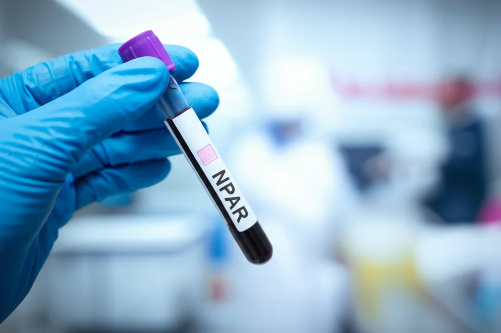 Primo piano di una provetta di sangue etichettata con 'NPAR' tenuta da una mano guantata in un ambiente di laboratorio moderno e luminoso. Lente prime 50mm, profondità di campo ridotta per mettere a fuoco la provetta, illuminazione da laboratorio chiara e pulita.