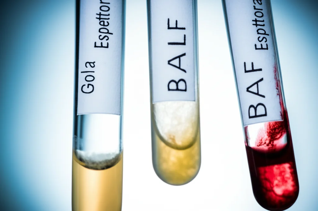 Primo piano di tre campioni biologici in provette da laboratorio etichettate 'Gola', 'Espettorato', 'BALF', con diverse torbidità che rappresentano il microbiota. Macro lens, 100mm, high detail, precise focusing, controlled lighting.
