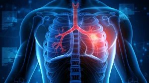 Visualizzazione 3D dettagliata dei polmoni umani all'interno della gabbia toracica, con evidenza di un pneumotorace sul lato destro (polmone parzialmente collassato e aria nello spazio pleurico), sfondo medico astratto blu scuro, illuminazione drammatica che evidenzia l'area interessata, alta definizione, stile illustrativo medico realistico.
