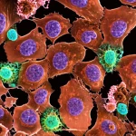 Visualizzazione artistica del microambiente tumorale del fegato, con fibroblasti eCAF (CD90+ LAMA4+) che interagiscono con cellule T CD8+, inducendone la senescenza. Macro lens, 60mm, high detail, controlled lighting, focus on cell interaction.