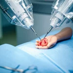 Fotografia macro di un braccio robotico chirurgico Da Vinci che sutura delicatamente un modello di rene umano in un ambiente operatorio sterile, illuminazione controllata, alta definizione, obiettivo macro 100mm, focus preciso sulla sutura.