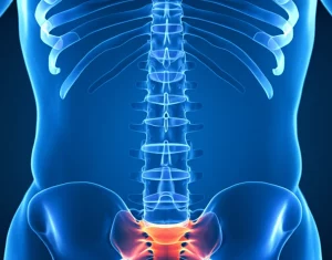 Visualizzazione 3D medica della colonna vertebrale e del bacino di un paziente con mieloma multiplo, che mostra un evidente aumento della cifosi toracica (curvatura in avanti) e possibili lesioni ossee. Macro lens, 70mm, alta definizione, illuminazione controllata per evidenziare la deformità spinale e il contesto clinico.