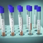 Visualizzazione concettuale del dilemma diagnostico tra pancreatite autoimmune e cancro al pancreas: due percorsi divergenti che originano da un esame del sangue con valore CA19-9 elevato, stile fotorealistico con profondità di campo, obiettivo 50mm, luce drammatica che illumina le provette e i percorsi.