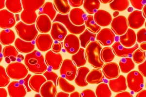 Immagine fotorealistica, obiettivo macro 100mm, che mostra globuli rossi al microscopio, alcuni di dimensioni variabili (anisocitosi, RDW elevato), illuminazione controllata ad alto dettaglio, a simboleggiare i biomarcatori della Policitemia Vera usati nello studio PV-AIM per predire la resistenza all'idrossiurea.
