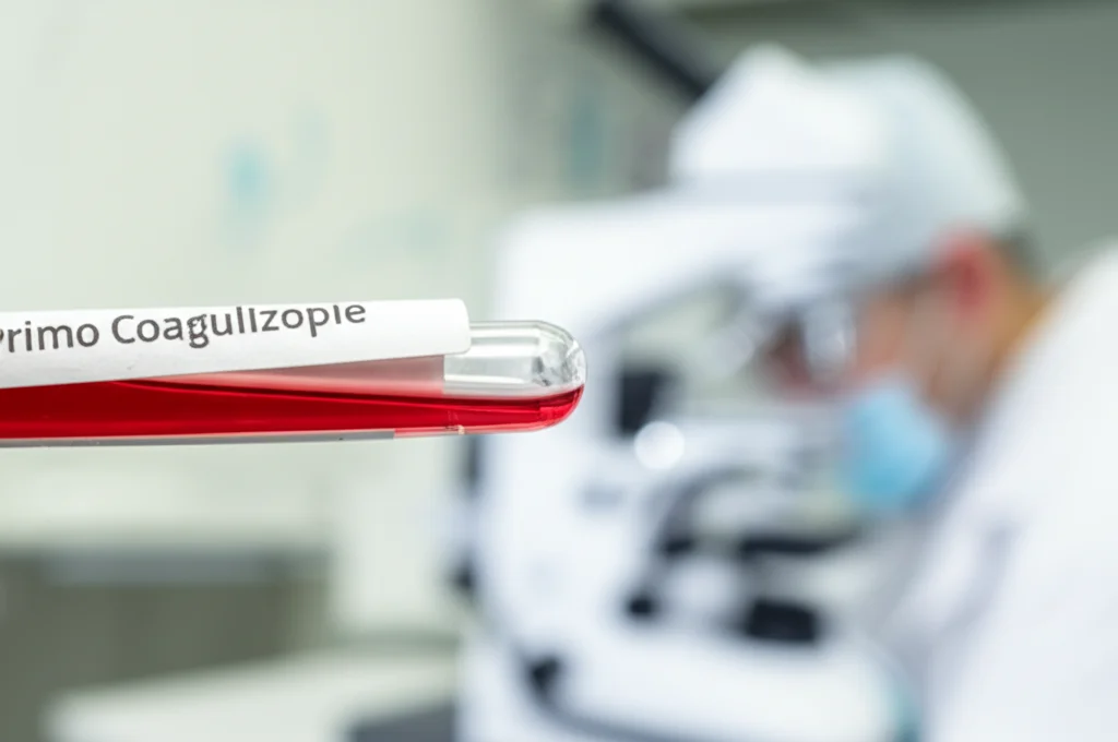 Primo piano macro di una provetta di sangue con sfondo sfocato di un laboratorio medico, illuminazione controllata, alta definizione, lente macro 100mm, focus preciso sui componenti del sangue, rappresentativa degli esami di coagulazione.