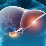 Immagine medica concettuale che mostra un fascio di radioterapia ad alta precisione (IGRT) mirato a un fegato umano con evidenziata la vena porta affetta da trombosi tumorale (PVTT). Lo sfondo è tecnologico e pulito, simboleggiando l'avanzamento della tecnica. Stile fotorealistico, illuminazione controllata da studio, leggero effetto profondità di campo, obiettivo 50mm prime.